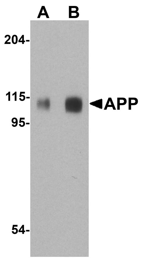 Anti App Ct Antibody Qed Bioscience Inc