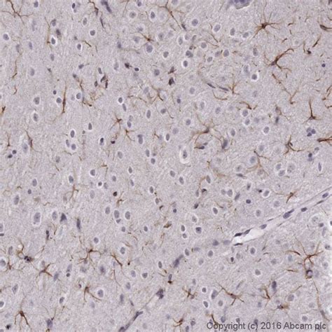 Anti-GFAP antibody (ab4674) | Abcam