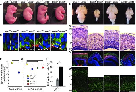 Requirements For Lamin Bs In Brain Development A E18 5 Embryos B