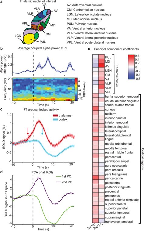 7 T Imaging Shows Two Primary Activity Modes At Behavioral Arousal Download Scientific Diagram