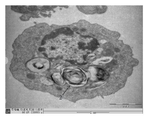 The Morphology Of Primary Cultured AECIIs Of Rat After Treatment Of