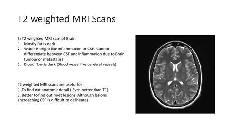 Mri Brain Sequences Ppt