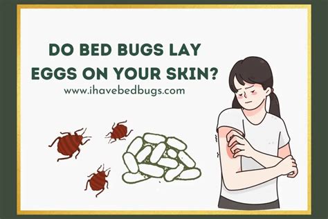 Do Bed Bugs Lay Eggs on Your Skin? - ihavebedbugs.com