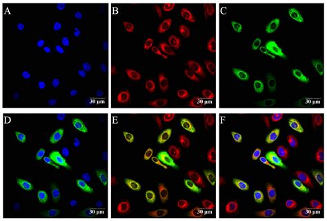 Cebpa Regulated Expression Of Socs1 Suppresses Milk Protein Synthesis