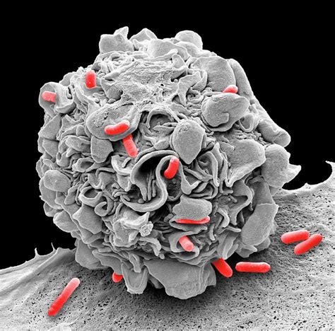 Macrophage Engulfing E Coli Bacteria By Steve Gschmeissner Science