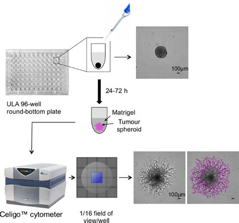 Three Dimensional 3d Tumor Spheroid Invasion Assay Scientific Article Protocol Jove