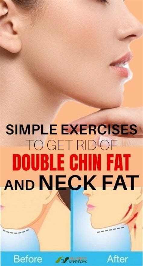 Pin On How To Lose Face Fat Fast