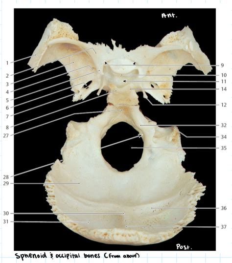 Sphenoid Occipital Bones Superior Diagram Quizlet