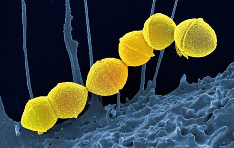 Streptococcus Pyogenes Group A Strep Colorized Scanning Flickr