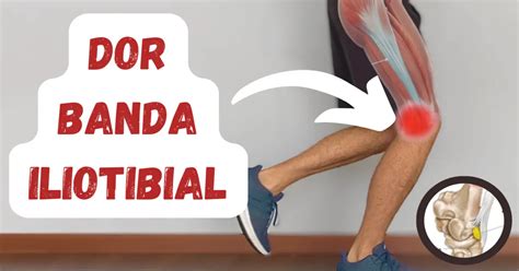 S Ndrome Da Banda Iliotibial Fisioterapia Rpg E Pilates Em Pa O De