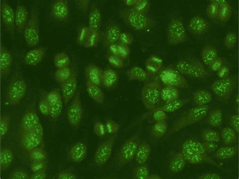 Anti Nuclear Antibodies Ana Positive Control Nucleolar Pattern