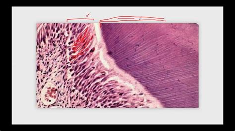 Histología de la pulpa dental Esquema conceptual YouTube