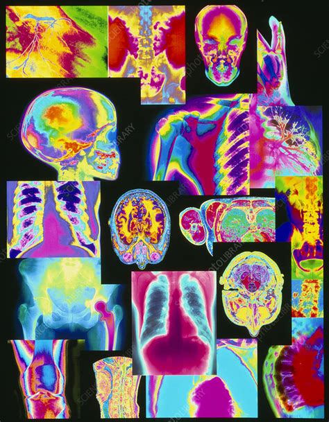 Assortment Of Coloured X Rays And Body Scans Stock Image M415 0370 Science Photo Library