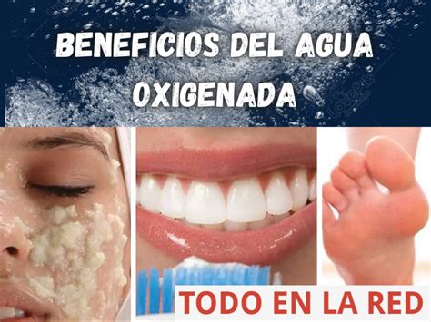 Beneficios Del Agua Oxigenada Todo En La Red