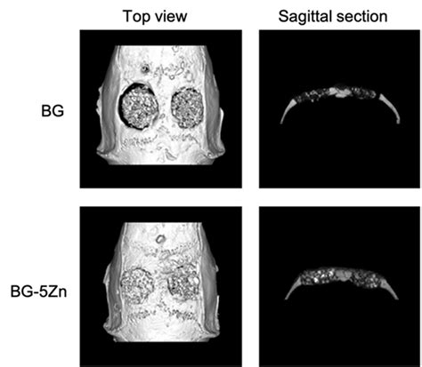 Micro Ct Evaluation Of Bone Regeneration In The Rat Calvarial Defects