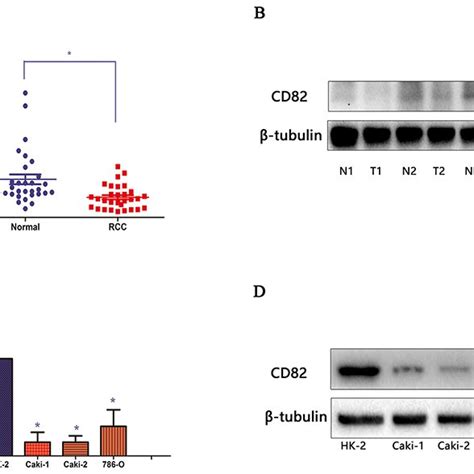 Cd Is Downregulated In Rcc Tissues And Cells Cd Level In Rcc