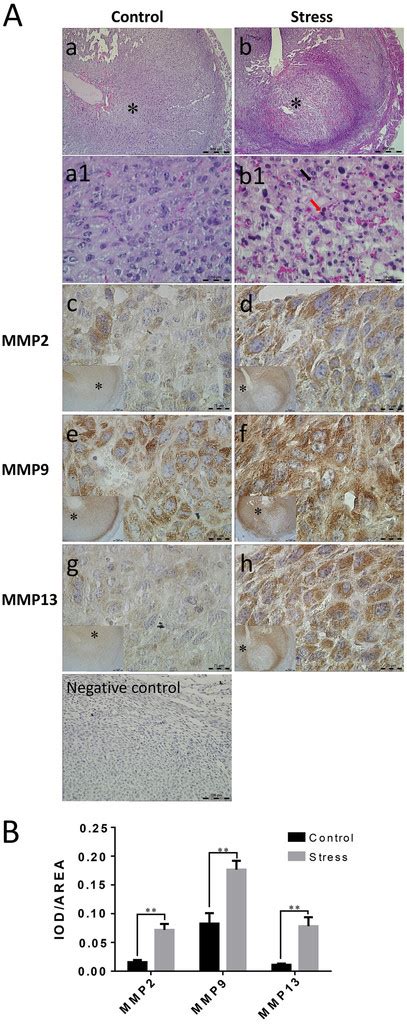 Acute Restraint Stress Triggers Progesterone Withdrawal And Endometrial