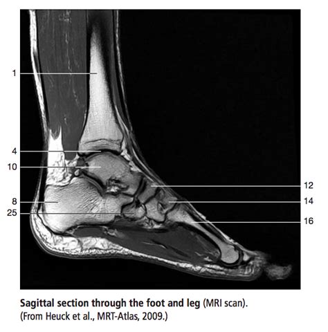 Diagram of foot (MRI) | Quizlet