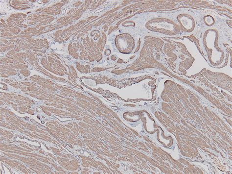 Actin Smooth Muscle Histology Slides