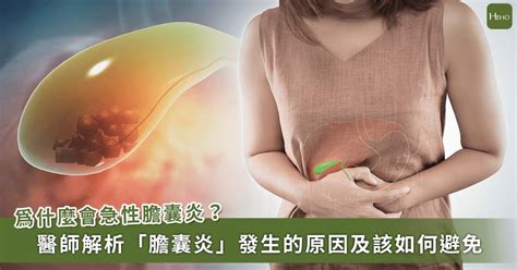 白家綺「急性膽囊炎」開刀！ 膽結石患者怎麼避免惡化到發炎？ Heho健康 Line Today