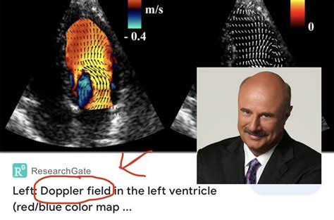 Doppler Field Name Soundalikes Know Your Meme