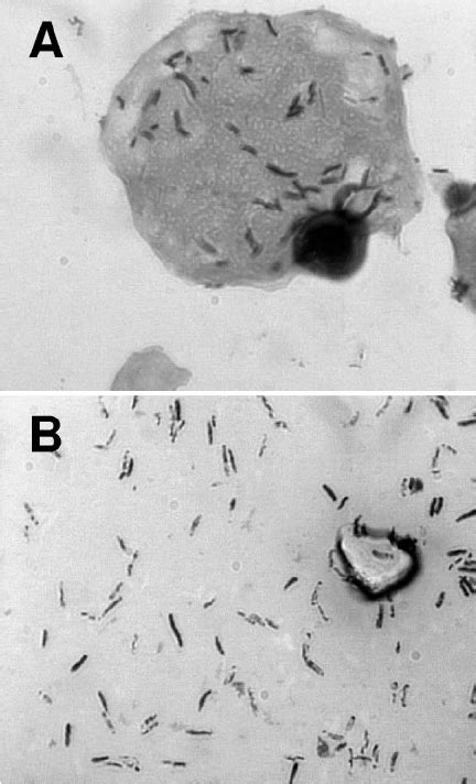 Light Micrographs Magnification Of Gram Stained