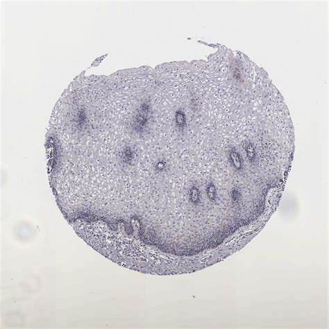 Tissue Expression Of Naga Staining In Vagina The Human Protein Atlas