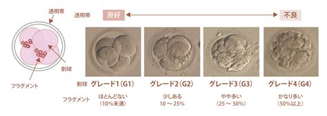 胚培養高崎ARTクリニック不妊治療 体外受精 高度生殖医療