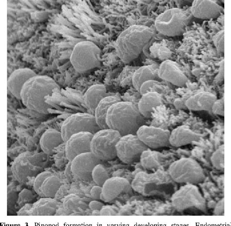 Figure 3 From Mechanisms Of Action Of Mifepristone And Levonorgestrel