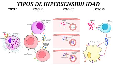 Hipersensibilidad tipo IV en qué consiste y ejemplos