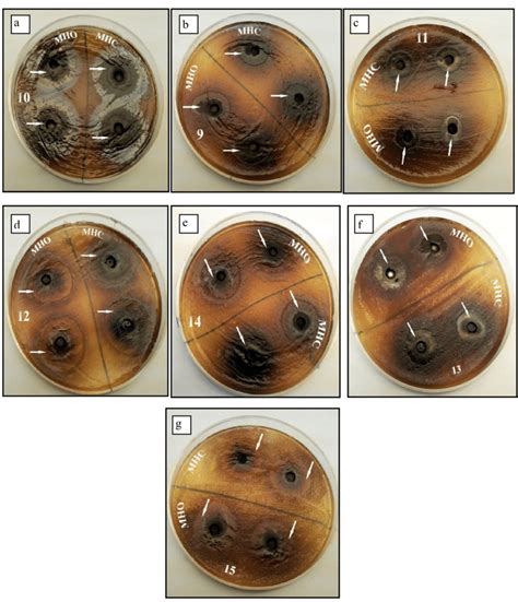 Screening By Agar Well Diffusion Method Showing The Inhibition Zone