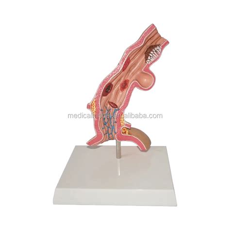 Human Rectum And Anal Canal Model Alibaba