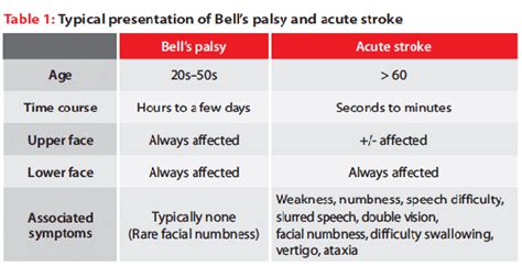 Bell S Palsy Vs Stroke New Health Advisor