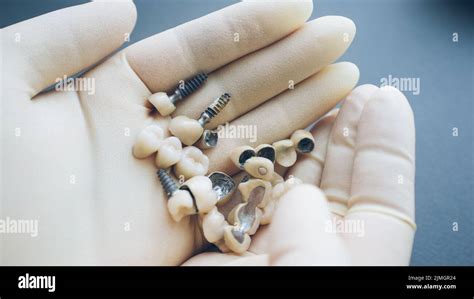 Teeth Reconstruction Dental Ceramic Implants Hands Stock Photo Alamy