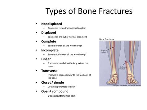 Signs of toe fracture: Broken toe – Symptoms and causes