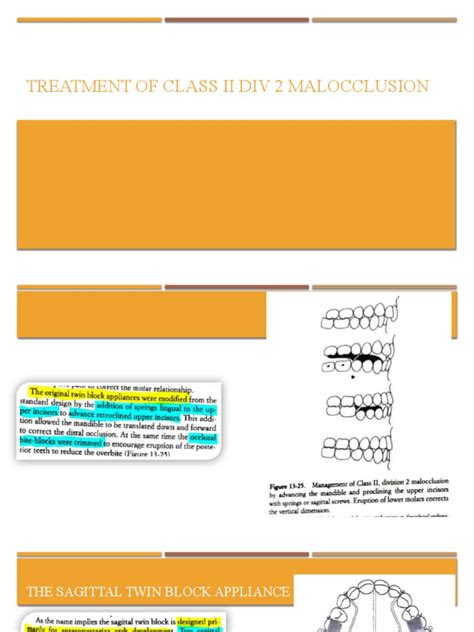 Treatment Of Class Ii Div 2 Malocclusion Twin Block Pdf