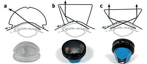 Gonioscopy Primer Insights From A Gonioscopy Workshop Part 1 Insight