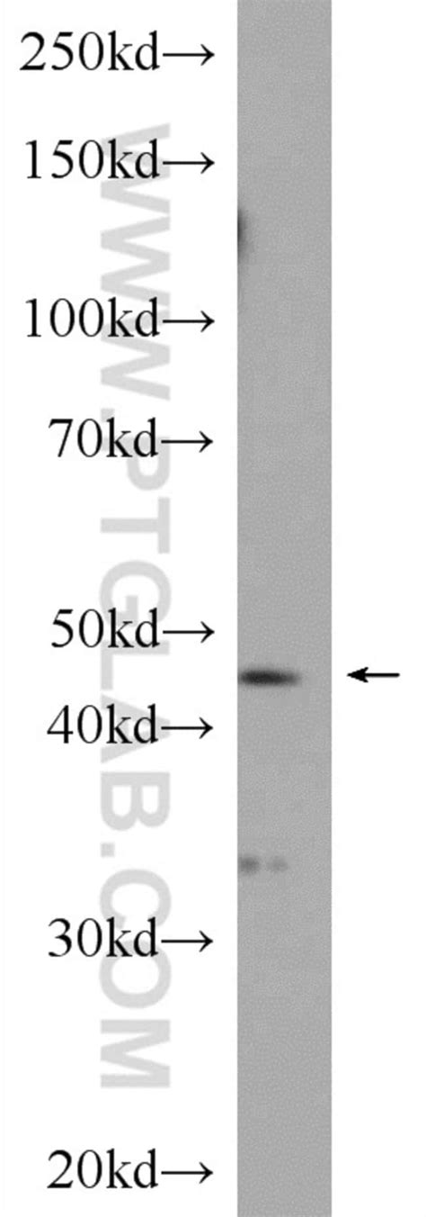 SERPINE2 Rabbit anti Human Mouse Rat Polyclonal Proteintech 20 μL