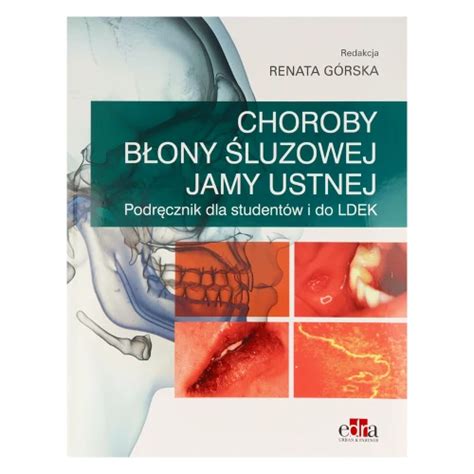 Edra Urban Partner Choroby błony śluzowej DentalTree Internetowy