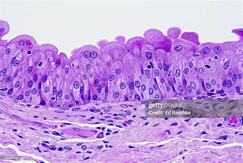 Transitional Epithelium Of Human Bladder H E Stain Cells Near The