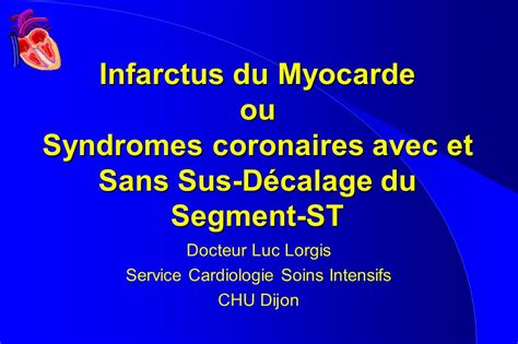 Infarctus Du Myocarde Ou Syndromes Coronaires Avec Et Sans Sus D Calage