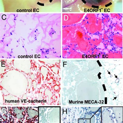 E4orf1 Ecs Maintain Their Angiogenic Potential In Vivo Mice Received