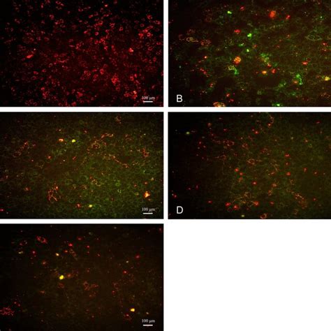 Typical Images Of Western Blotting 1 Control 2 H2O2 3 Idebenone