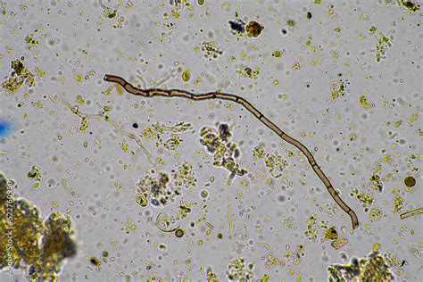 soil microbes organisms in a soil and compost sample, fungus and fungi and under the microscope ...