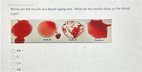 Solved Below are the results of a blood typing test. What do | Chegg.com