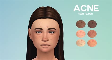 [boredsimblr] Acne | Sims 4, Sims, Sims 4 cc skin