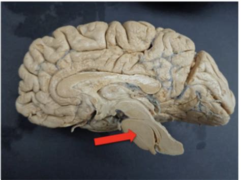 MSMS Neuroscience Lab Flashcards Quizlet