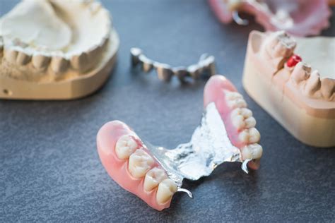 The Advantages Of Partial Dentures