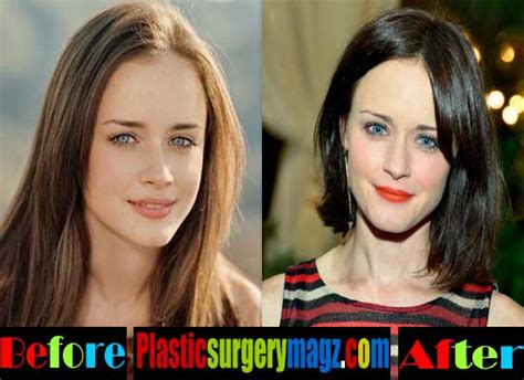 Alexis Bledel Plastic Surgery Before And After Fact Or Hoax