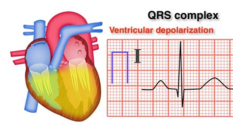 How To Measure Qrs Complex On An Ecg